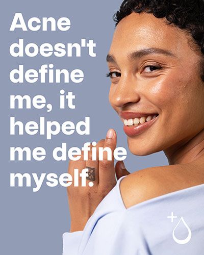 acne-skin-care-treatment-spokane Face Reality Education & Services for Acne Skin Care Treatment in Spokane